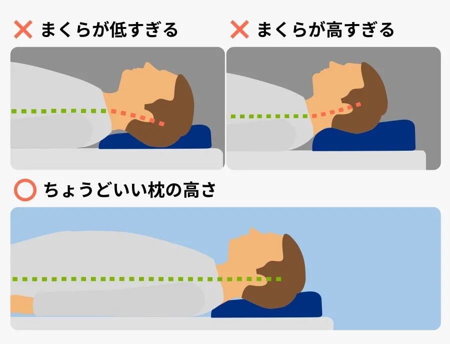枕の高さと頸椎の変化